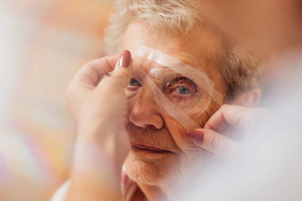 Cataract Surgery Aftercare 2025: Recovery & Eye Drop Tips
