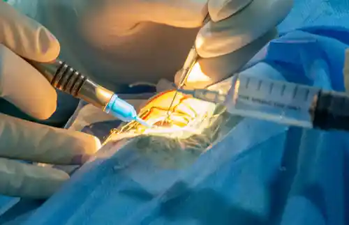 glaucoma specialist in kolkata