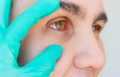 glaucoma specialists in kolkata