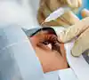 cataract eye treatment in kolkata