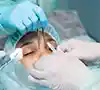 cost for cataract surgery