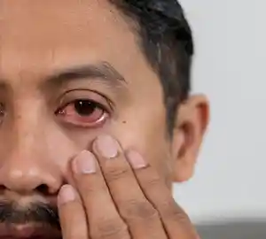 eye treatment